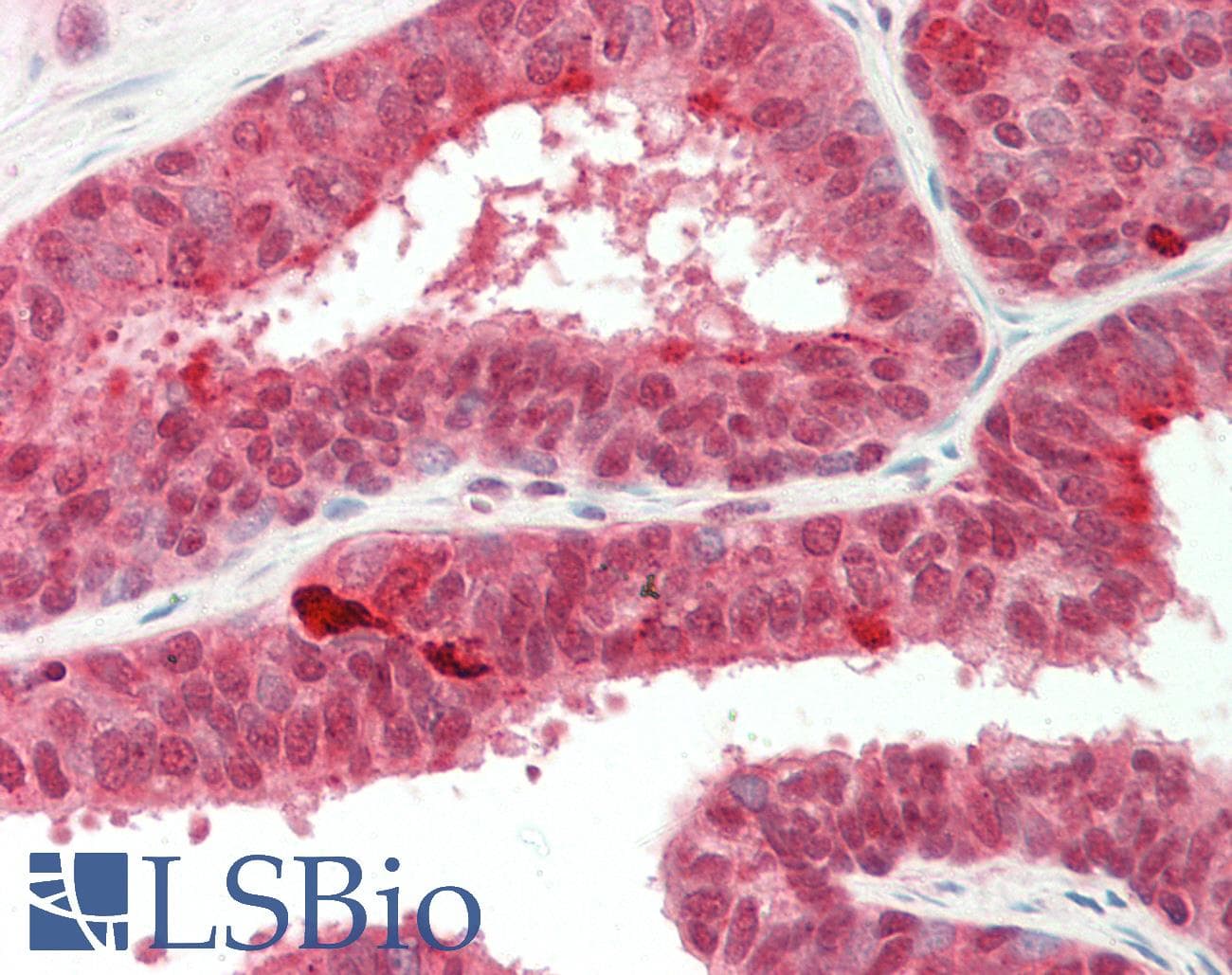 YWHAQ / 14-3-3 Theta Antibody (aa45-94)