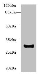 Polyclonal Rabbit anti-Human TMEM41A Antibody (IHC, WB)