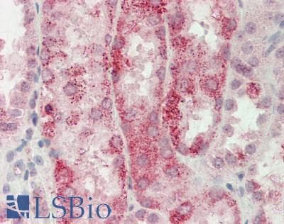 Polyclonal Rabbit anti-Mouse CDKN3 / KAP Antibody (aa67-116, IHC, WB)
