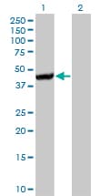 Monoclonal Mouse anti-Human CTH / Cystathionase Antibody (clone 4E1-1B7, WB)