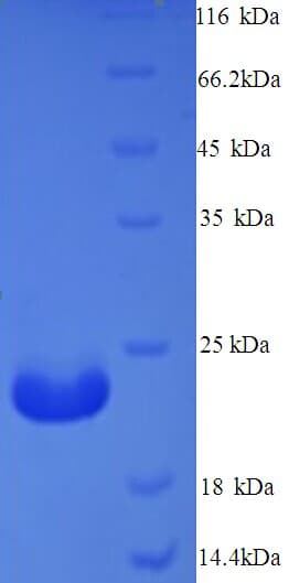 Mycobacterium tuberculosis M. tuberculosis MPT64 Protein (Recombinant 6His, N-terminus)