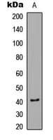 Polyclonal Rabbit anti-Human CAMK1 / CAMKI Antibody (phospho-Thr177, IHC, IF, WB)