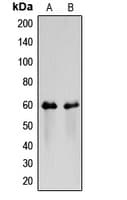 CSF2RA / CD116 Antibody (Internal)