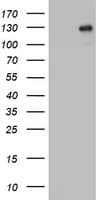 PR / Progesterone Receptor Antibody (aa1-298, clone OTI18B12)