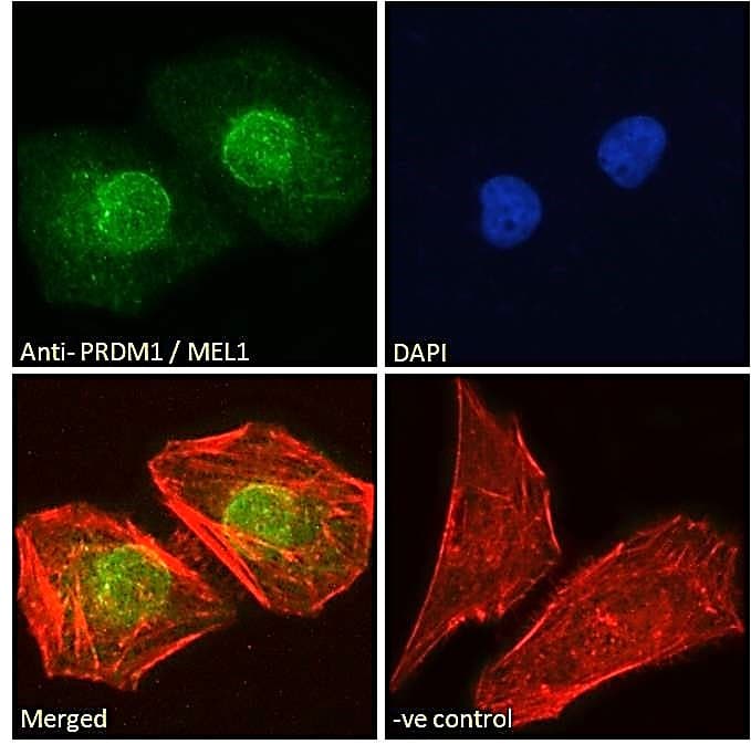 IHC-plus™ Polyclonal Goat anti-Human BLIMP1 / PRDM1 Antibody (aa698-711, IHC, IF, WB)