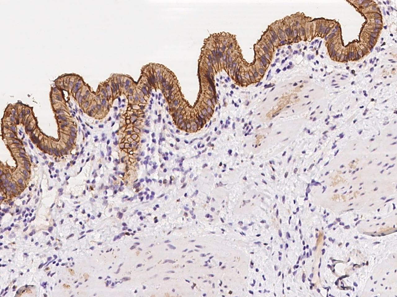 Polyclonal Rabbit anti-Human PLD1 / Phospholipase D1 Antibody (IHC)