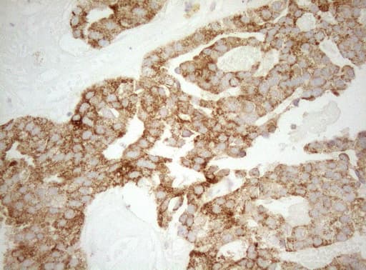 DECR1 Antibody (clone OTI5D12)