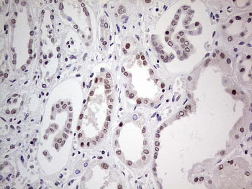 PPP1R8 / Rnase E Antibody (aa1-225, clone OTI5H9)