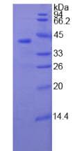 Human TNNT1 / TNT Protein (Recombinant His)