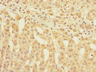 Polyclonal Rabbit anti-Human GLP2R Antibody (IHC)