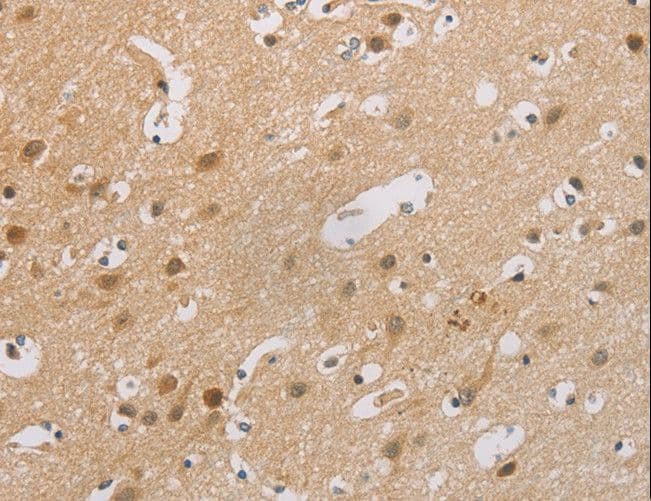 Polyclonal Rabbit anti-Human p16INK4a / CDKN2A Antibody (IHC)