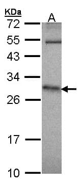 HPRT1 / HPRT Antibody (aa1-218)