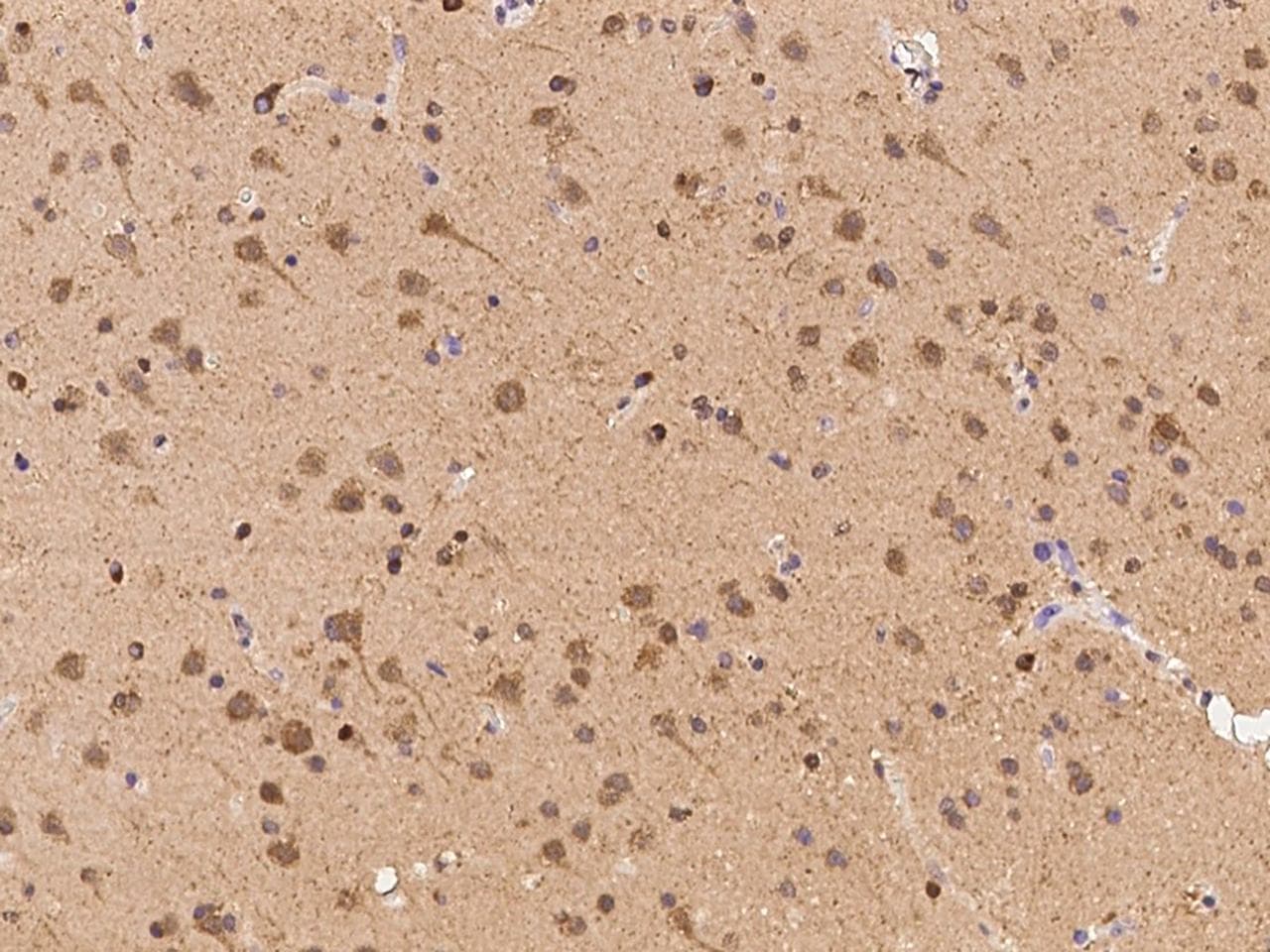CCT5 / TCP1 Epsilon Antibody