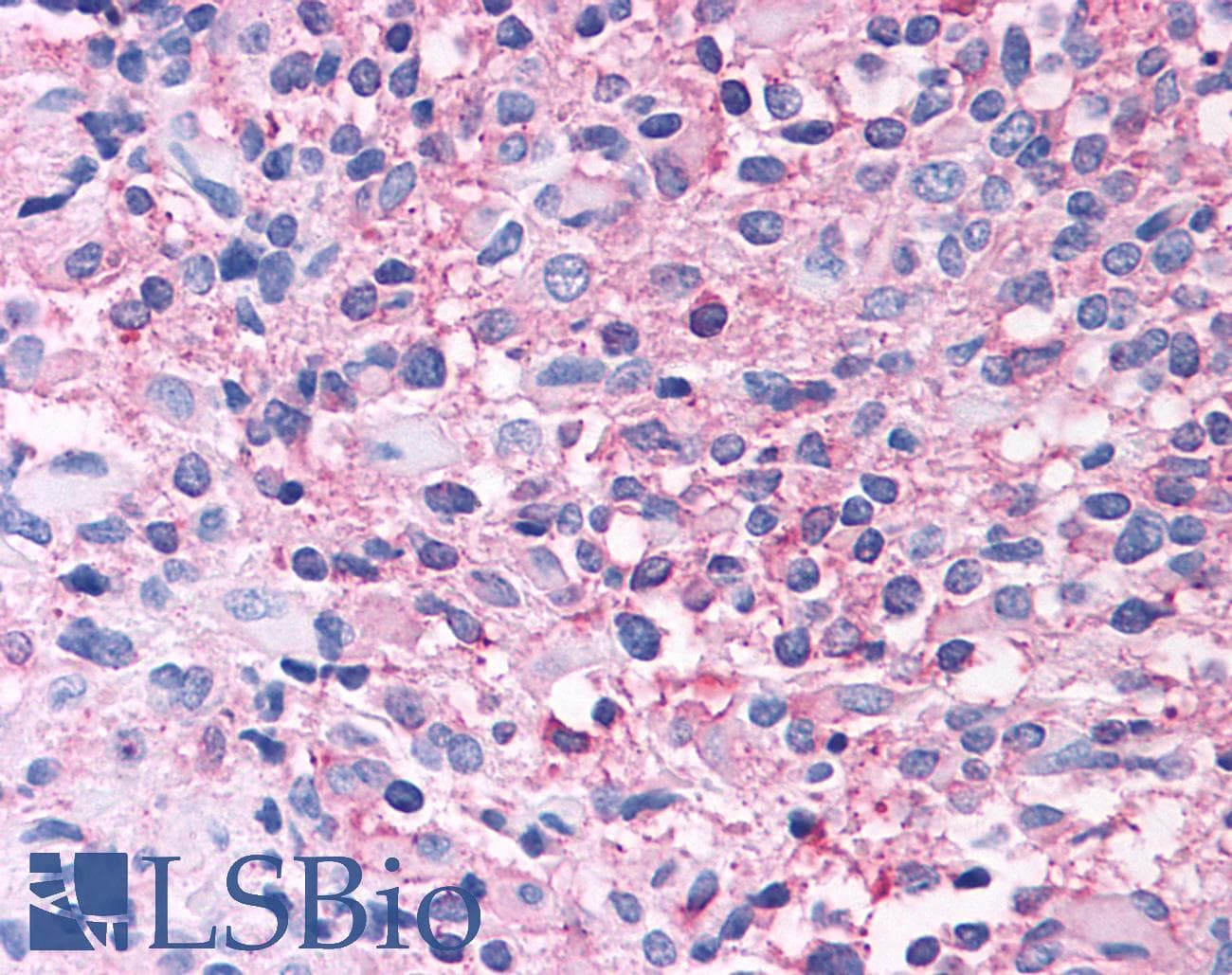 PathPlus™ GRM2 / MGLUR2 Antibody (N-Terminus)