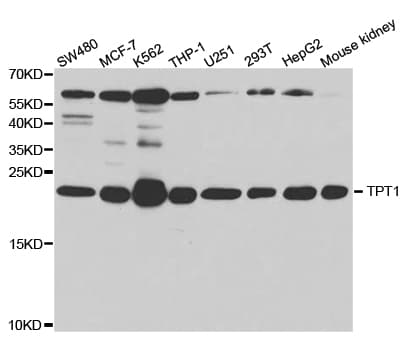 Polyclonal Rabbit anti-Human TPT1 / TCTP Antibody (IHC, IF, WB)