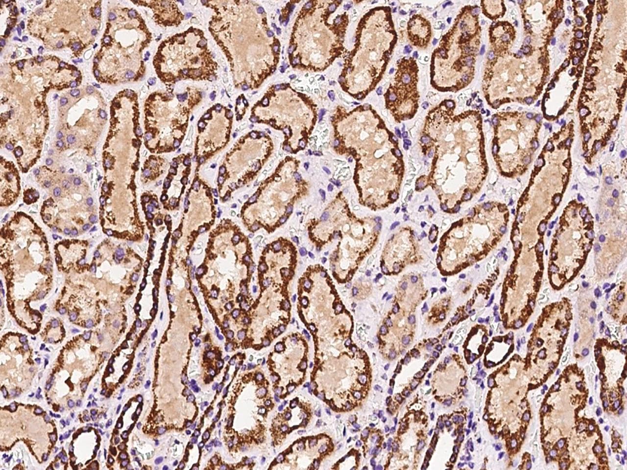 ATP5H Antibody