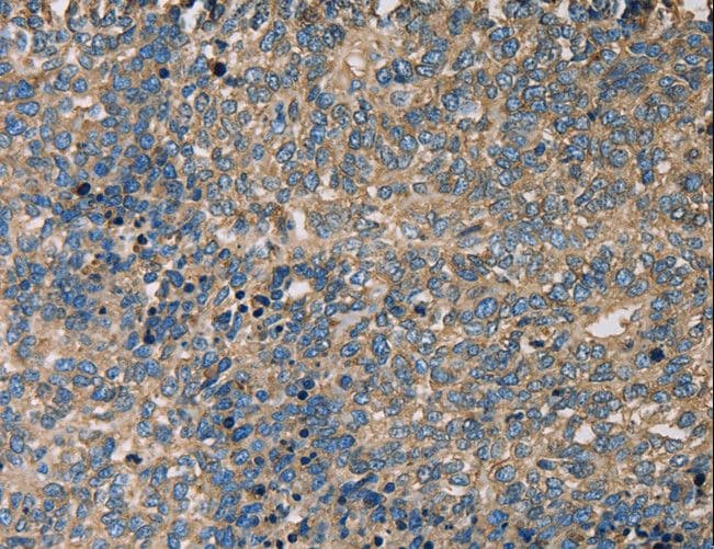 SERPINA1 / Alpha 1 Antitrypsin Antibody