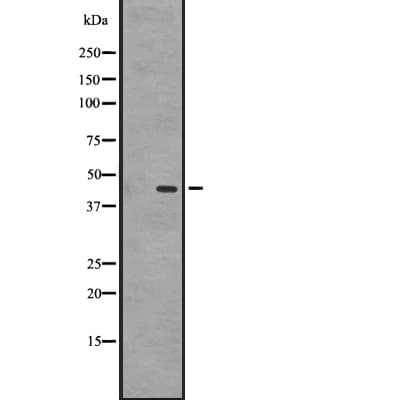 GPR87 Antibody
