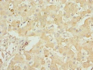 GLYCTK / Glycerate Kinase Antibody