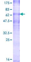 Human CDS2 Protein (Recombinant GST)