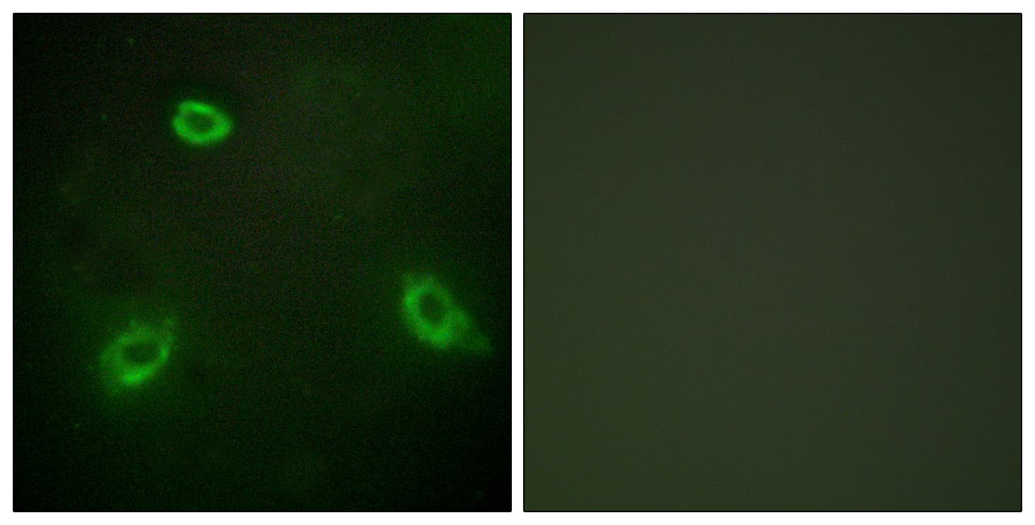 Polyclonal Rabbit anti-Human ANO7 / TMEM16G / NGEP Antibody (aa881-930, IHC, IF)