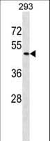 Polyclonal Rabbit anti-Human ZNF191 / ZNF24 Antibody (aa220-248, WB)