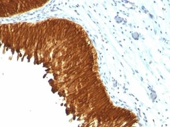 Pan Cytokeratin Antibody (clone KRT/457, Ready-to-Use)
