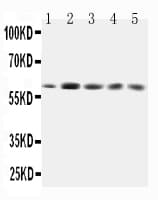 Polyclonal Rabbit anti-Human GRB7 Antibody (aa176-192, IHC, WB)