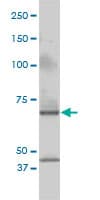 Monoclonal Mouse anti-Human CSTF2 / CstF-64 Antibody (clone 3D1-3A6, IHC, WB)