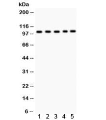 Polyclonal Rabbit anti-Human SLC4A1 / Band 3 / AE1 Antibody (aa28-365, IHC, WB)