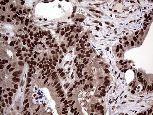 Monoclonal Mouse anti-Human PPP4C Antibody (clone OTI2E4, Carrier-free, IHC, WB)