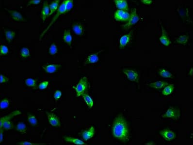 Polyclonal Rabbit anti-Human Apg7 / ATG7 Antibody