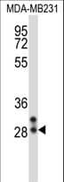 NEUROG2 / NGN2 / Neurogenin 2 Antibody (aa95-124)