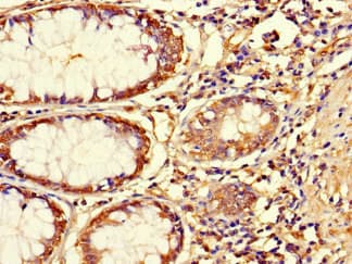 IHC-plus™ ASPN / Asporin Antibody