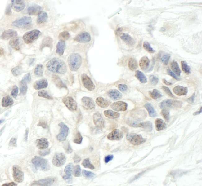 ARID2 Antibody (aa1785-1835)