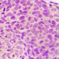 STK24 / MST3 Antibody (C-Terminus)