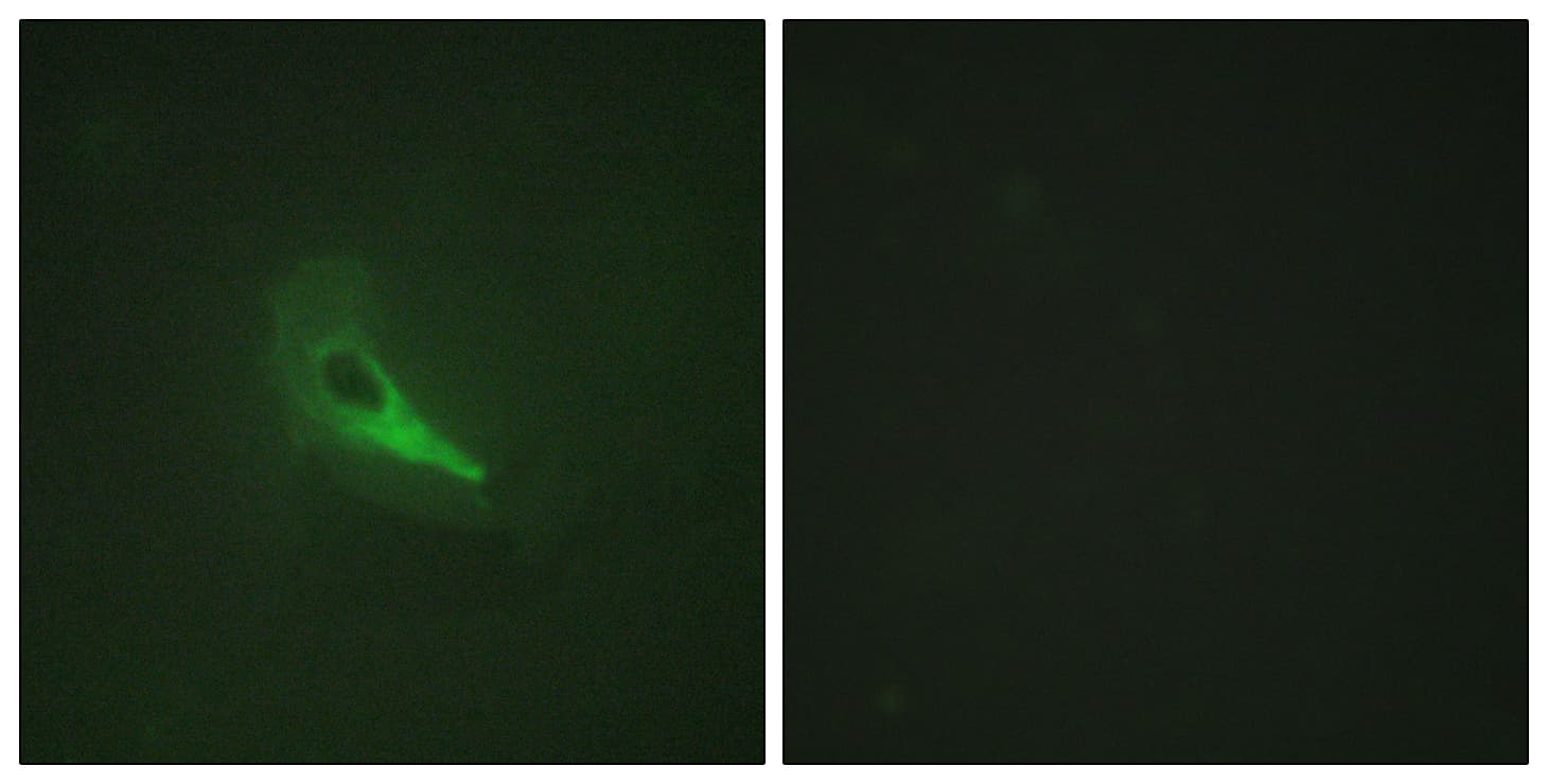 Gravin / AKAP12 Antibody (aa301-350)