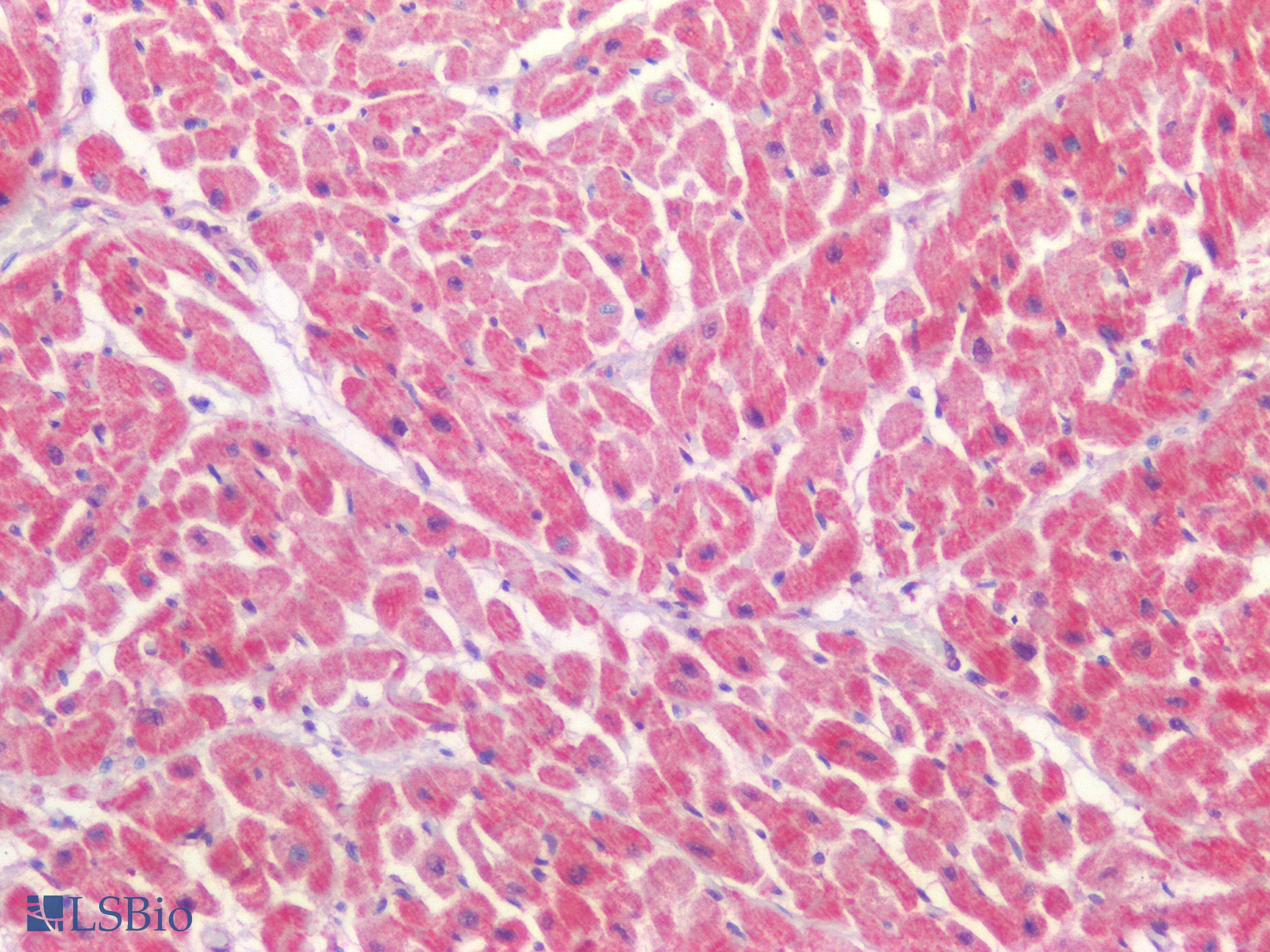 PathPlus™ LAMA1 / Laminin Alpha 1 Antibody