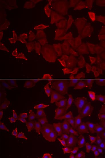MARCKSL1 Antibody