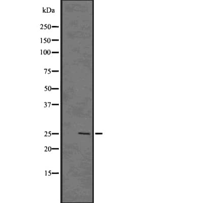 GSCL / GSC2 Antibody