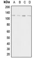 Polyclonal Rabbit anti-Human ADCY1 / Adenylate Cyclase 1 Antibody (Internal, IHC, WB)