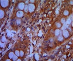 CHD3 Antibody (clone 2G4)