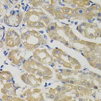 Polyclonal Rabbit anti-Human SLC30A1 / ZNT1 Antibody (IHC, WB)