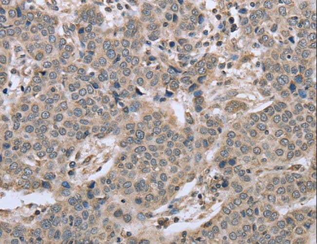 RHEB Antibody