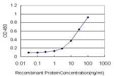 Monoclonal Mouse anti-Human ADCY5 / Adenylate Cyclase 5 Antibody (clone 3E6, WB)