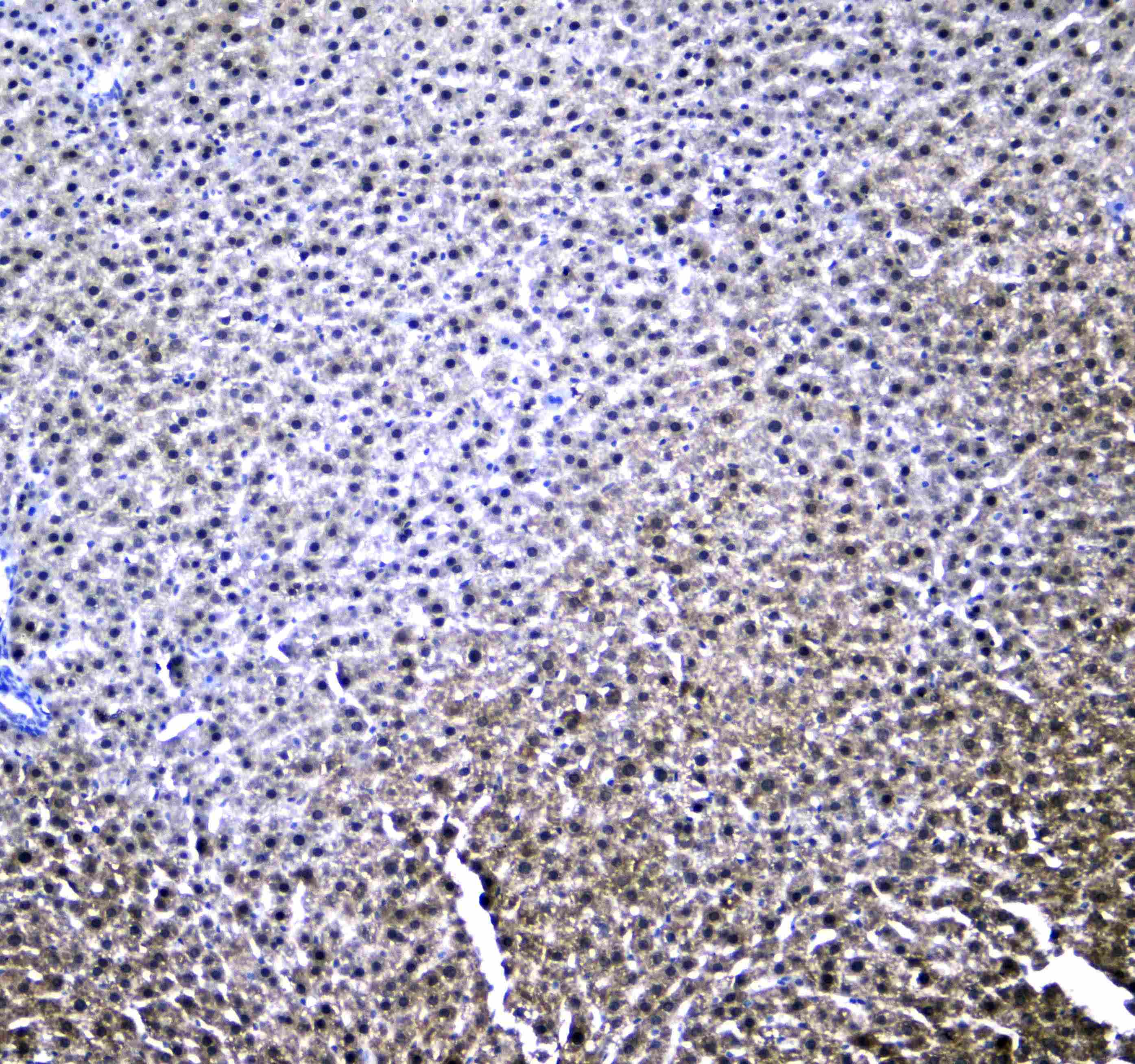 Polyclonal Rabbit anti-Human RXTA / RXR-Alpha Antibody (IHC, WB)