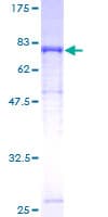 Human LBP Protein (Recombinant GST)