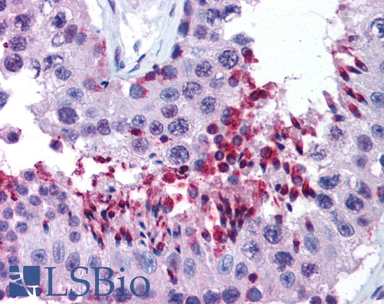 Polyclonal Rabbit anti-Human WRNIP1 / WHIP Antibody (aa67-116, IHC, WB)