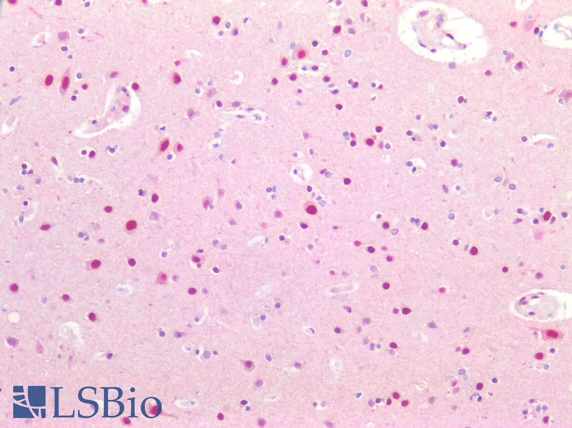 PathPlus™ CCNL2 / Cyclin L2 Antibody