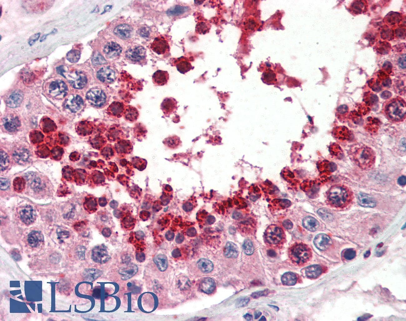 IHC-plus™ Polyclonal Goat anti-Human GPX4 / MCSP Antibody (aa184-196, IHC, WB)